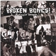 Broken Bones - A Singles Decade